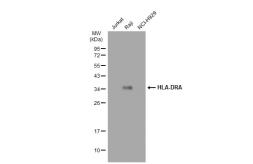 Anti-HLA-DRA antibody [SC06-78] used in Western Blot (WB). GTX01049
