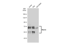 Anti-Ikaros antibody [JB50-38] used in Western Blot (WB). GTX01051