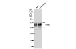 Anti-CD46 antibody [JB25-49] used in Western Blot (WB). GTX01058