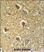 Anti-HAS2 antibody used in IHC (Paraffin sections) (IHC-P). GTX01068