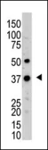 Anti-UCHL5 antibody used in Western Blot (WB). GTX01069