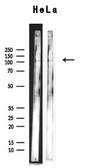Anti-XRN2 antibody used in Western Blot (WB). GTX01072