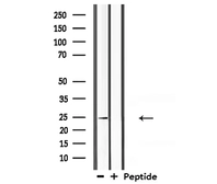 Anti-Claudin 10 antibody used in Western Blot (WB). GTX01076