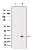 Anti-Lipocalin-2 antibody used in Western Blot (WB). GTX01078