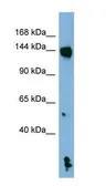 Anti-NALP1 antibody used in Western Blot (WB). GTX01082