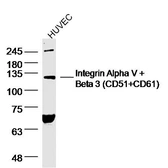 Anti-Integrin alpha V + beta 3 antibody used in Western Blot (WB). GTX01084