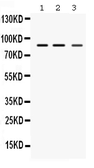 Anti-MEFV antibody used in Western Blot (WB). GTX01088