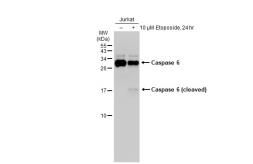 Anti-Caspase 6 antibody [GT1154] used in Western Blot (WB). GTX01097