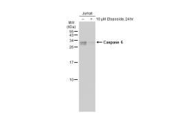 Anti-Caspase 6 antibody [GT1155] used in Western Blot (WB). GTX01098