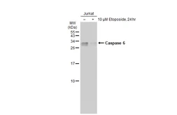 Anti-Caspase 6 antibody [GT1155] used in Western Blot (WB). GTX01098