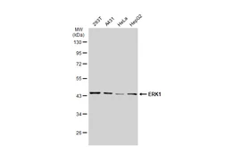 Anti-ERK1 antibody [GT1156] used in Western Blot (WB). GTX01099