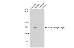 Anti-PDGF Receptor alpha antibody [JF104-6] used in Western Blot (WB). GTX01102