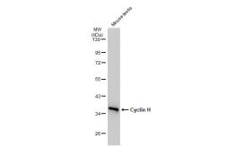 Anti-Cyclin H antibody [SN20-48] used in Western Blot (WB). GTX01109