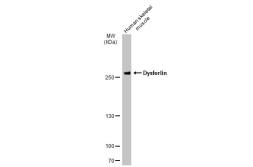 Anti-Dysferlin antibody [JF05-54] used in Western Blot (WB). GTX01110
