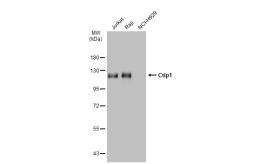 Anti-Ctip1 antibody [JB35-68] used in Western Blot (WB). GTX01115