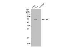 Anti-CD27 antibody [JB40-98] used in Western Blot (WB). GTX01122