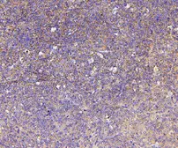 Anti-ARID2 antibody used in IHC (Paraffin sections) (IHC-P). GTX01135