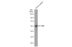 Anti-CD4 antibody [ST0488] used in Western Blot (WB). GTX01136