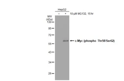Anti-c-Myc (phospho Thr58/Ser62) antibody [SZ02-06] used in Western Blot (WB). GTX01137