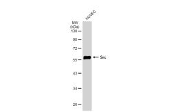 Anti-Src antibody [JF0947] used in Western Blot (WB). GTX01138