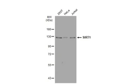 Anti-SIRT1 antibody [SZ04-01] used in Western Blot (WB). GTX01139