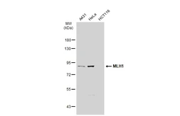 Anti-MLH1 antibody [SP08-04] used in Western Blot (WB). GTX01140