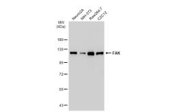 Anti-FAK antibody [SR46-04] used in Western Blot (WB). GTX01141