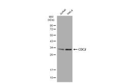 Anti-CDC2 antibody [SM01-44] used in Western Blot (WB). GTX01143