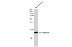 Anti-Cystatin C antibody [JJ09-16] used in Western Blot (WB). GTX01145