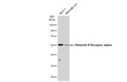 Anti-Retinoid X Receptor alpha antibody [JG99-38] used in Western Blot (WB). GTX01146