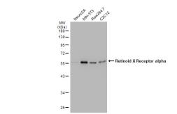 Anti-Retinoid X Receptor alpha antibody [JG99-38] used in Western Blot (WB). GTX01146