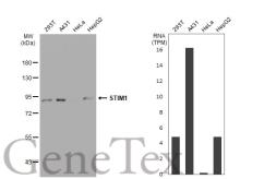 Anti-STIM1 antibody [SD0814] used in Western Blot (WB). GTX01149