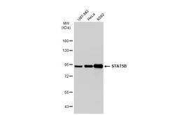Anti-STAT5B antibody [SD08-08] used in Western Blot (WB). GTX01153