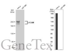 Anti-L1CAM antibody [JM11-05] used in Western Blot (WB). GTX01156