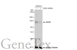Anti-ACE2 antibody [SN0754] used in Western Blot (WB). GTX01160