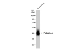Anti-Podoplanin antibody [JM31-21] used in Western Blot (WB). GTX01168
