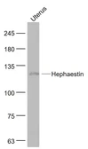 Anti-Hephaestin antibody used in Western Blot (WB). GTX01178
