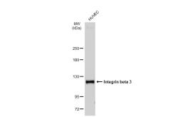 Anti-Integrin beta 3 antibody [SJ19-09] used in Western Blot (WB). GTX01182