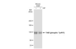 Anti-TrkB (phospho Tyr816) antibody [SC0556] used in Western Blot (WB). GTX01183