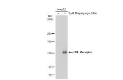 Anti-LDL receptor antibody [SJ0197] used in Western Blot (WB). GTX01185