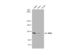 Anti-JAK2 antibody [GT1214] used in Western Blot (WB). GTX01195