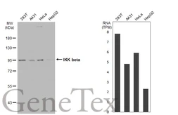 Anti-IKK beta antibody [GT1216] used in Western Blot (WB). GTX01197