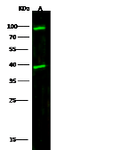 Anti-Cathepsin L antibody used in Western Blot (WB). GTX01211