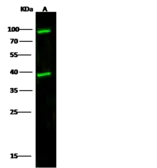 Anti-Cathepsin L antibody used in Western Blot (WB). GTX01211