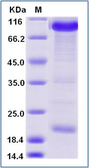 Human PCSK9 protein, mouse IgG1 Fc tag. GTX01240-pro