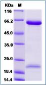 Human PCSK9 protein, His tag. GTX01241-pro