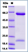 Human PCSK9 protein, His tag. GTX01241-pro