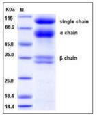 Human HGF protein (active). GTX01262-pro