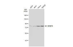 Anti-STAT3 antibody [GT1159] used in Western Blot (WB). GTX01294