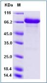 Human Alpha fetoprotein / AFP protein, human IgG1 Fc tag. GTX01317-pro